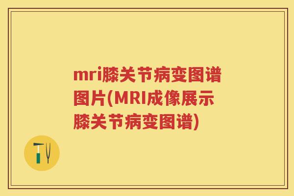mri膝关节变图谱图片(MRI成像展示膝关节变图谱)