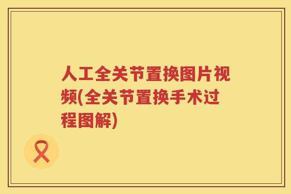 人工全关节置换图片视频(全关节置换手术过程图解) 人工全关节置换图片视频(全关节置换手术过程图解)