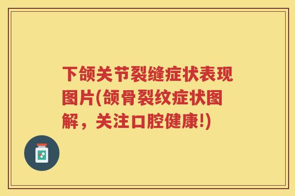 下颌关节裂缝症状表现图片(颌骨裂纹症状图解,关注口腔健康!) 下颌关节裂缝症状表现图片(颌骨裂纹症状图解,关注口腔健康!)