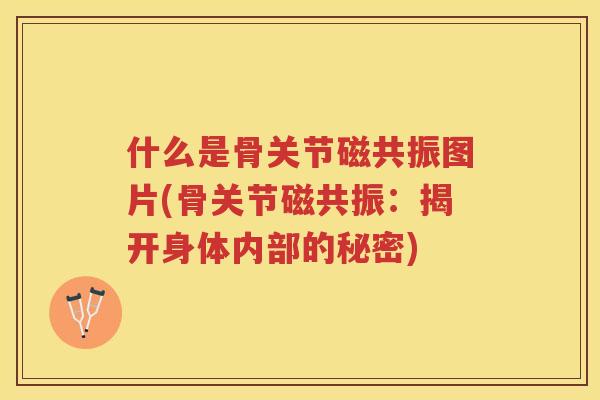 什么是骨关节磁共振图片(骨关节磁共振：揭开身体内部的秘密)