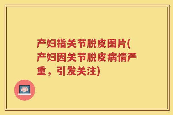 产妇指关节脱皮图片(产妇因关节脱皮情严重,引发关注) 产妇指关节脱皮图片(产妇因关节脱皮情严重,引发关注)