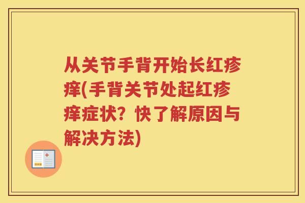 从关节手背开始长红疹痒(手背关节处起红疹痒症状?快了解原因与解决方法) 从关节手背开始长红疹痒(手背关节处起红疹痒症状?快了解原因与解决方法)