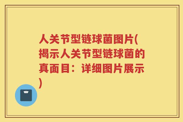 人关节型链球菌图片(揭示人关节型链球菌的真面目:详细图片展示) 人关节型链球菌图片(揭示人关节型链球菌的真面目:详细图片展示)