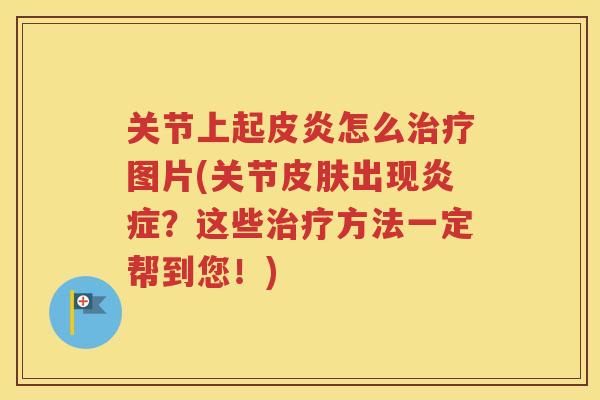 关节上起皮炎怎么图片(关节出现?这些方法一定帮到您!) 关节上起皮炎怎么图片(关节出现?这些方法一定帮到您!)