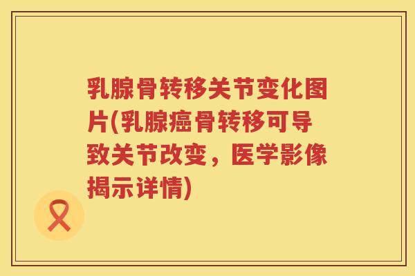 乳腺骨转移关节变化图片(乳腺骨转移可导致关节改变,医学影像揭示详情) 乳腺骨转移关节变化图片(乳腺骨转移可导致关节改变,医学影像揭示详情)