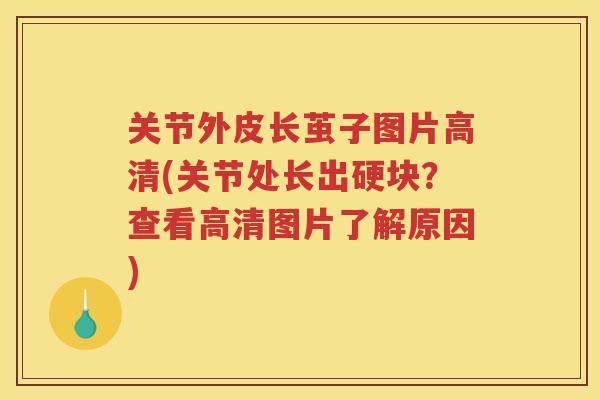关节外皮长茧子图片高清(关节处长出硬块?查看高清图片了解原因) 关节外皮长茧子图片高清(关节处长出硬块?查看高清图片了解原因)
