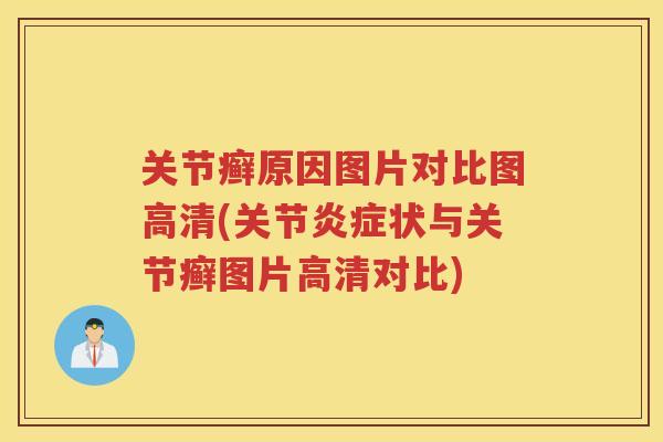 关节癣原因图片对比图高清(关节状与关节癣图片高清对比) 关节癣原因图片对比图高清(关节状与关节癣图片高清对比)