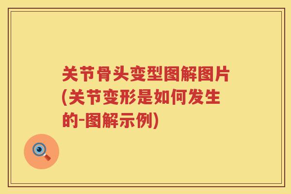 关节骨头变型图解图片(关节变形是如何发生的-图解示例) 关节骨头变型图解图片(关节变形是如何发生的-图解示例)