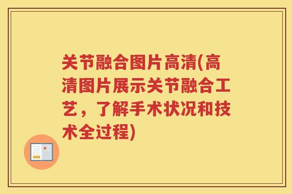 关节融合图片高清(高清图片展示关节融合工艺，了解手术状况和技术全过程)