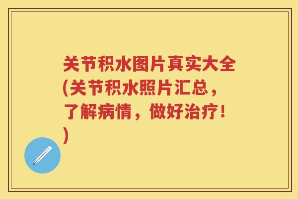 关节积水图片真实大全(关节积水照片汇总,了解情,做好!) 关节积水图片真实大全(关节积水照片汇总,了解情,做好!)