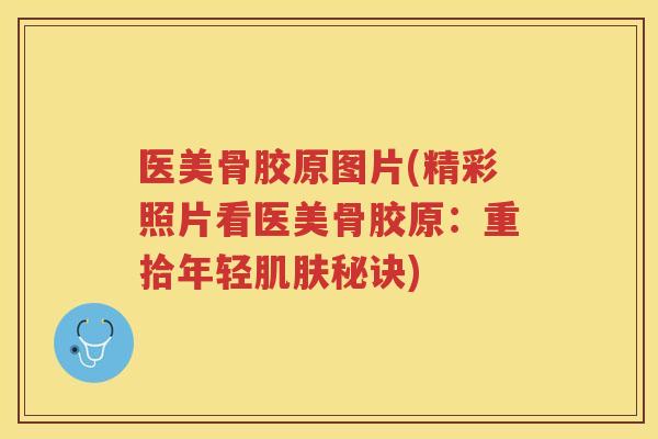 医美骨胶原图片(精彩照片看医美骨胶原：重拾年轻秘诀)