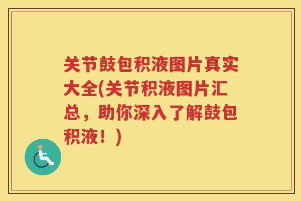 关节鼓包积液图片真实大全(关节积液图片汇总，助你深入了解鼓包积液！)