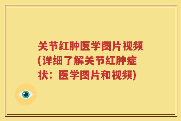 关节红肿医学图片视频(详细了解关节红肿症状:医学图片和视频) 关节红肿医学图片视频(详细了解关节红肿症状:医学图片和视频)