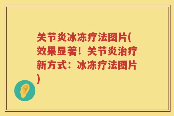 冰冻疗法图片(效果显著!新方式:冰冻疗法图片) 冰冻疗法图片(效果显著!新方式:冰冻疗法图片)