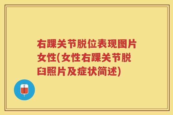 右踝关节脱位表现图片女性(女性右踝关节脱臼照片及症状简述) 右踝关节脱位表现图片女性(女性右踝关节脱臼照片及症状简述)