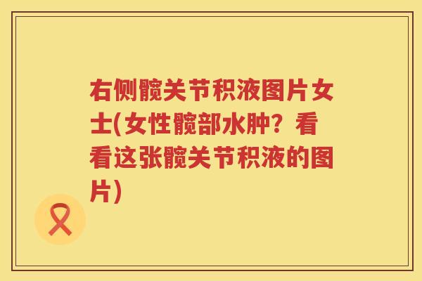 右侧髋关节积液图片女士(女性髋部水肿?看看这张髋关节积液的图片) 右侧髋关节积液图片女士(女性髋部水肿?看看这张髋关节积液的图片)