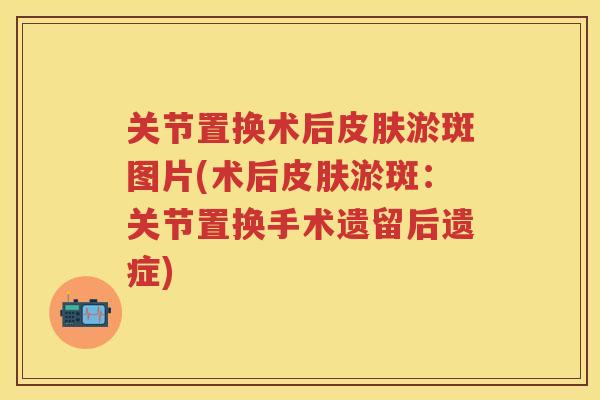 关节置换术后淤斑图片(术后淤斑:关节置换手术遗留后遗症) 关节置换术后淤斑图片(术后淤斑:关节置换手术遗留后遗症)