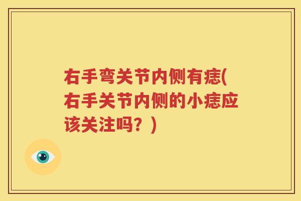 右手弯关节内侧有痣(右手关节内侧的小痣应该关注吗?) 右手弯关节内侧有痣(右手关节内侧的小痣应该关注吗?)