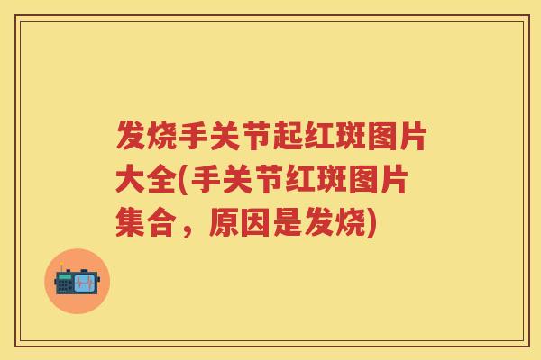 发烧手关节起红斑图片大全(手关节红斑图片集合,原因是发烧) 发烧手关节起红斑图片大全(手关节红斑图片集合,原因是发烧)