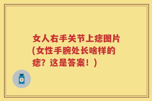 女人右手关节上痣图片(女性手腕处长啥样的痣?这是答案!) 女人右手关节上痣图片(女性手腕处长啥样的痣?这是答案!)