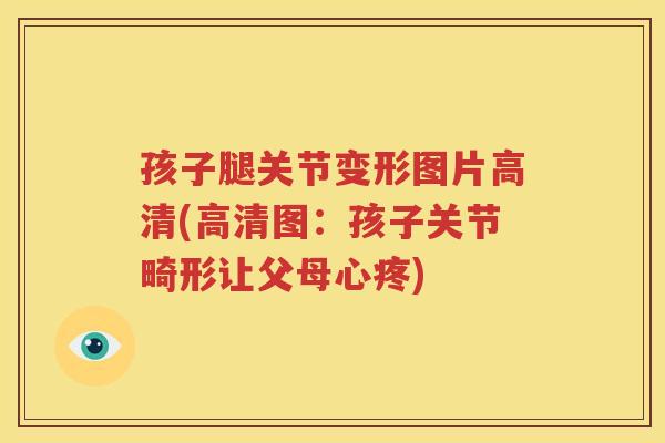 孩子腿关节变形图片高清(高清图：孩子关节畸形让父母心疼)