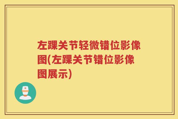 左踝关节轻微错位影像图(左踝关节错位影像图展示) 左踝关节轻微错位影像图(左踝关节错位影像图展示)