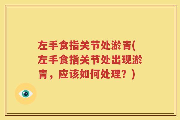 左手食指关节处淤青(左手食指关节处出现淤青,应该如何处理?) 左手食指关节处淤青(左手食指关节处出现淤青,应该如何处理?)