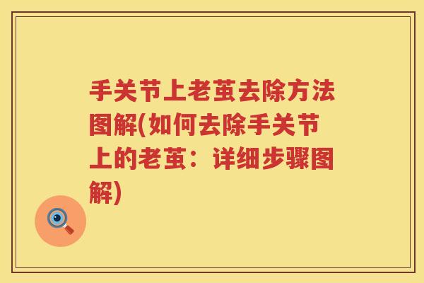 手关节上老茧去除方法图解(如何去除手关节上的老茧:详细步骤图解) 手关节上老茧去除方法图解(如何去除手关节上的老茧:详细步骤图解)