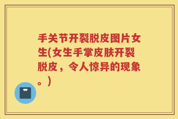 手关节开裂脱皮图片女生(女生手掌开裂脱皮,令人惊异的现象。) 手关节开裂脱皮图片女生(女生手掌开裂脱皮,令人惊异的现象。)