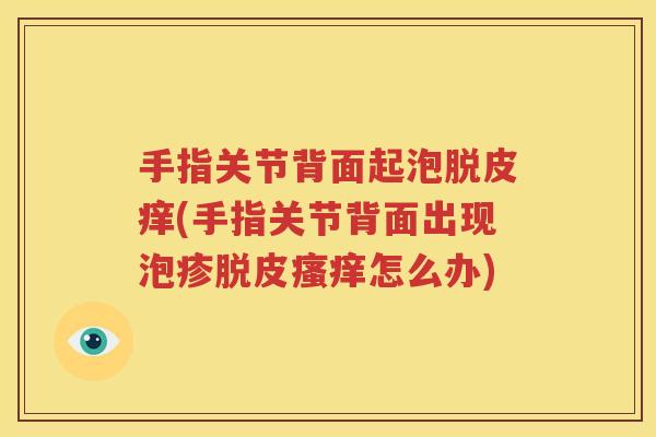手指关节背面起泡脱皮痒(手指关节背面出现泡疹脱皮怎么办) 手指关节背面起泡脱皮痒(手指关节背面出现泡疹脱皮怎么办)
