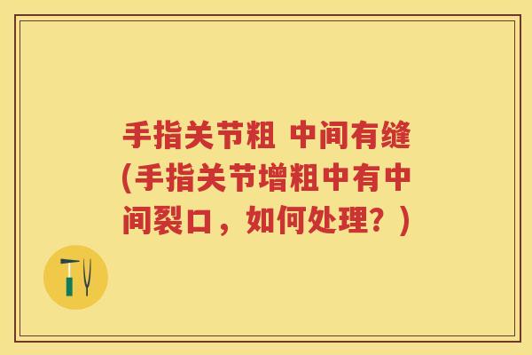手指关节粗 中间有缝(手指关节增粗中有中间裂口,如何处理?) 手指关节粗 中间有缝(手指关节增粗中有中间裂口,如何处理?)
