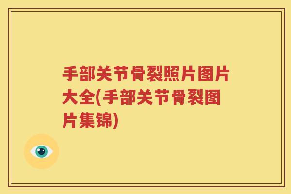 手部关节骨裂照片图片大全(手部关节骨裂图片集锦)