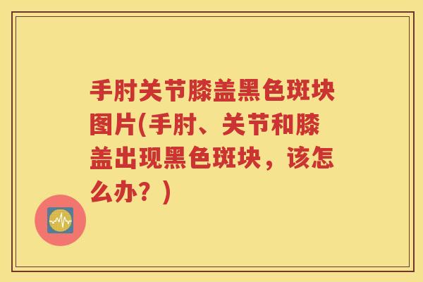 手肘关节膝盖黑色斑块图片(手肘、关节和膝盖出现黑色斑块,该怎么办?) 手肘关节膝盖黑色斑块图片(手肘、关节和膝盖出现黑色斑块,该怎么办?)