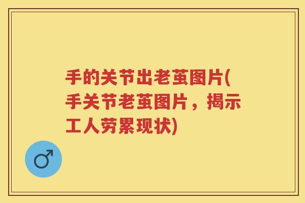 手的关节出老茧图片(手关节老茧图片,揭示工人劳累现状) 手的关节出老茧图片(手关节老茧图片,揭示工人劳累现状)