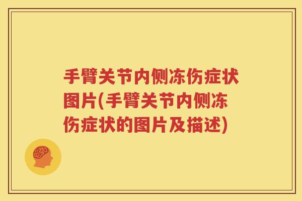手臂关节内侧冻伤症状图片(手臂关节内侧冻伤症状的图片及描述)