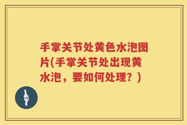 手掌关节处黄色水泡图片(手掌关节处出现黄水泡,要如何处理?) 手掌关节处黄色水泡图片(手掌关节处出现黄水泡,要如何处理?)