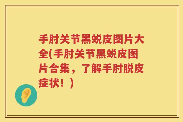 手肘关节黑蜕皮图片大全(手肘关节黑蜕皮图片合集,了解手肘脱皮症状!) 手肘关节黑蜕皮图片大全(手肘关节黑蜕皮图片合集,了解手肘脱皮症状!)