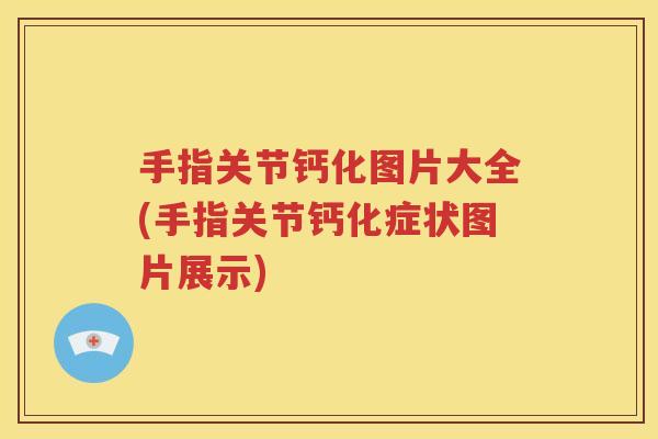 手指关节钙化图片大全(手指关节钙化症状图片展示) 手指关节钙化图片大全(手指关节钙化症状图片展示)