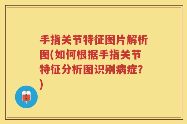 手指关节特征图片解析图(如何根据手指关节特征分析图识别症？)