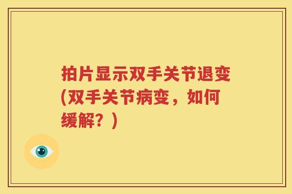 拍片显示双手关节退变(双手关节变，如何缓解？)