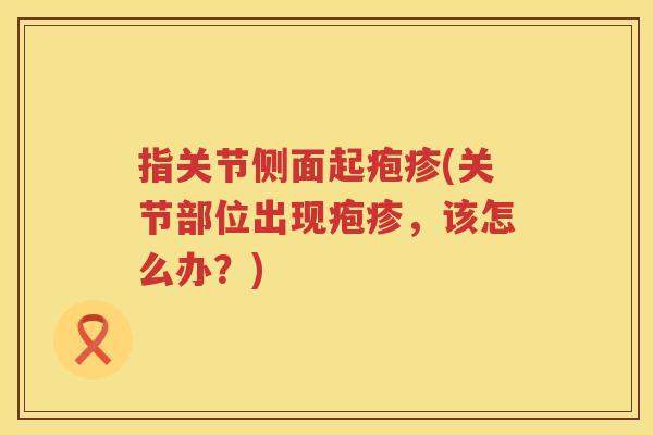 指关节侧面起疱疹(关节部位出现疱疹,该怎么办?) 指关节侧面起疱疹(关节部位出现疱疹,该怎么办?)