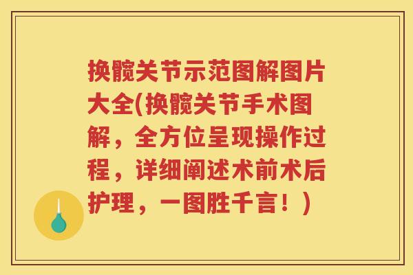 换髋关节示范图解图片大全(换髋关节手术图解,全方位呈现操作过程,详细阐述术前术后护理,一图胜千言!) 换髋关节示范图解图片大全(换髋关节手术图解,全方位呈现操作过程,详细阐述术前术后护理,一图胜千言!)