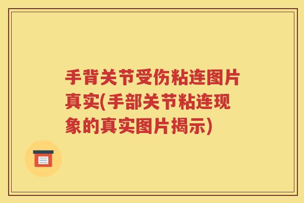 手背关节受伤粘连图片真实(手部关节粘连现象的真实图片揭示) 手背关节受伤粘连图片真实(手部关节粘连现象的真实图片揭示)