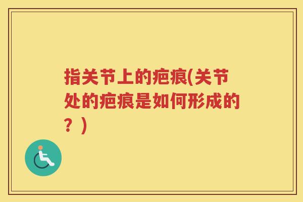 指关节上的疤痕(关节处的疤痕是如何形成的?) 指关节上的疤痕(关节处的疤痕是如何形成的?)