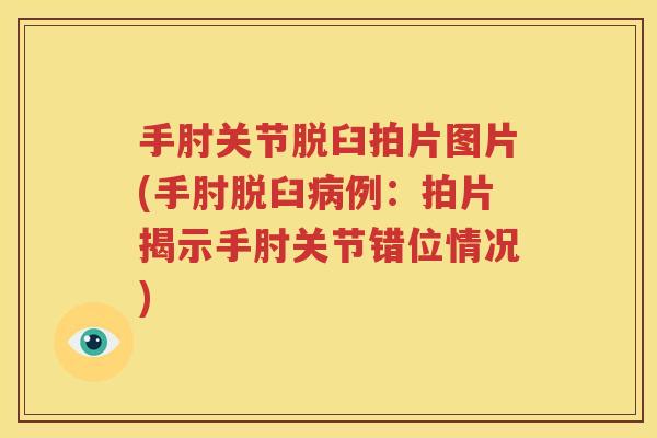 手肘关节脱臼拍片图片(手肘脱臼例:拍片揭示手肘关节错位情况) 手肘关节脱臼拍片图片(手肘脱臼例:拍片揭示手肘关节错位情况)