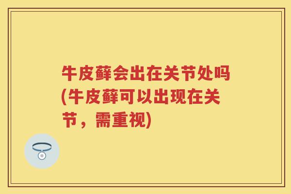 牛皮藓会出在关节处吗(牛皮藓可以出现在关节,需重视) 牛皮藓会出在关节处吗(牛皮藓可以出现在关节,需重视)