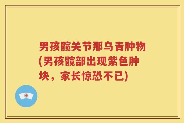 男孩髋关节那乌青肿物(男孩髋部出现紫色肿块,家长惊恐不已) 男孩髋关节那乌青肿物(男孩髋部出现紫色肿块,家长惊恐不已)