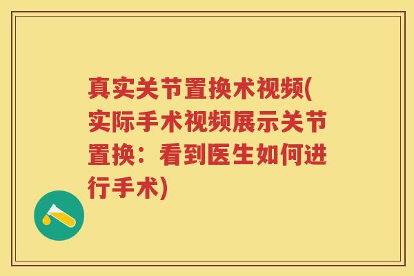 真实关节置换术视频(实际手术视频展示关节置换：看到医生如何进行手术)