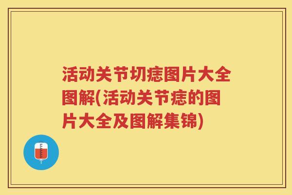 活动关节切痣图片大全图解(活动关节痣的图片大全及图解集锦) 活动关节切痣图片大全图解(活动关节痣的图片大全及图解集锦)