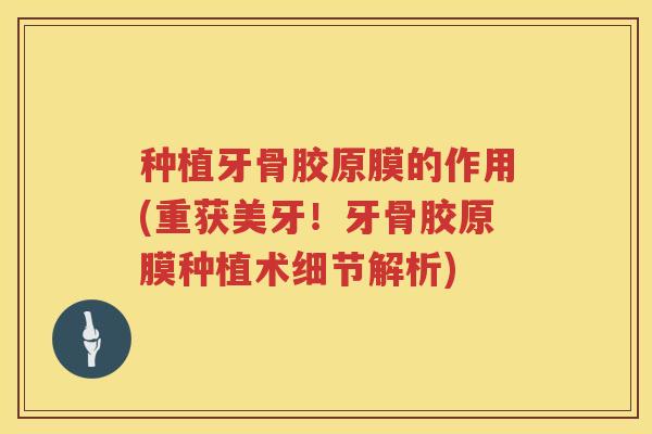 种植牙骨胶原膜的作用(重获美牙!牙骨胶原膜种植术细节解析) 种植牙骨胶原膜的作用(重获美牙!牙骨胶原膜种植术细节解析)